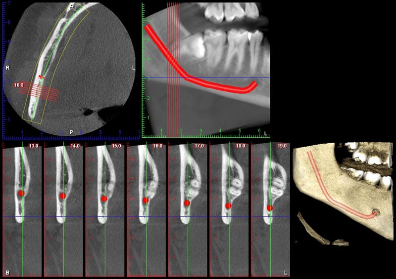 Cone Beam Image