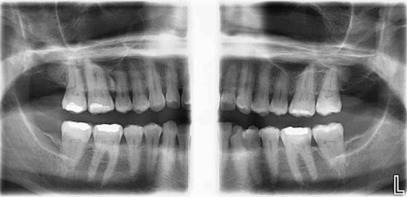 Cone Beam Image