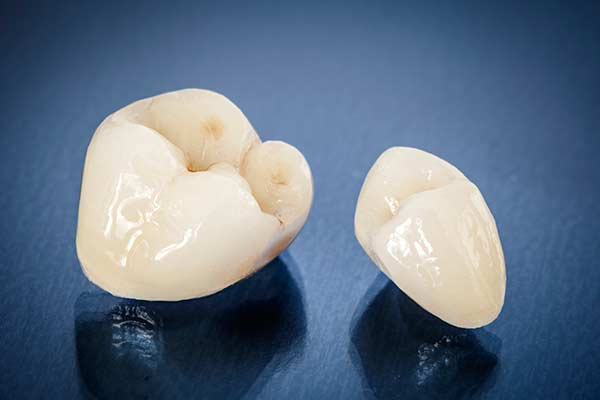 Restorative Dental Crowns