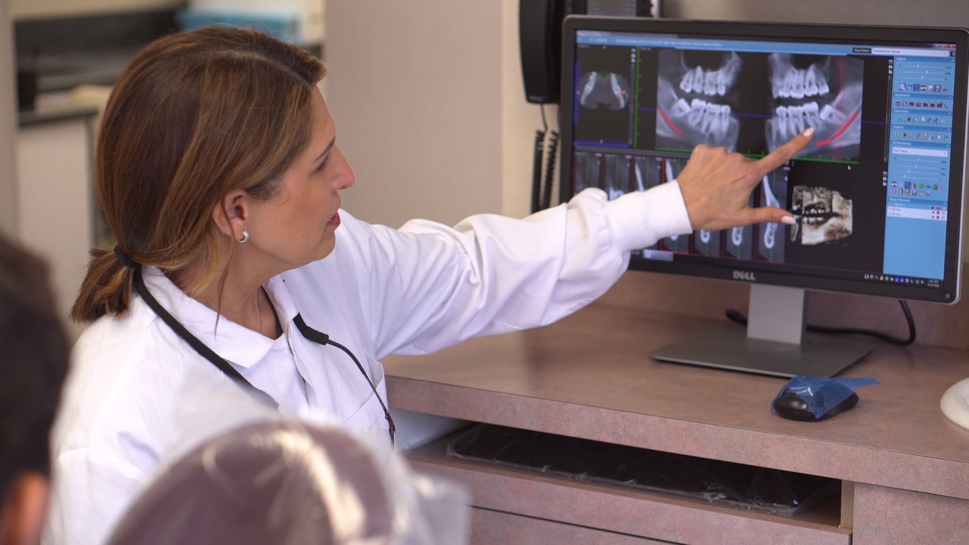 Dentist Explaining a Guided Implant Placement