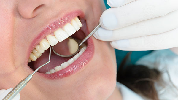 Close Up of Woman Undergoing a Scaling and Root Planing Procedure